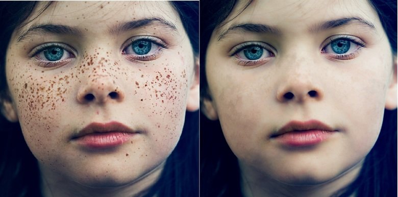 Celebrities stripped down. My (poor) attempt at what some famous (and not-so-famous) people might look like without their trademark freckles. Definitely seems l