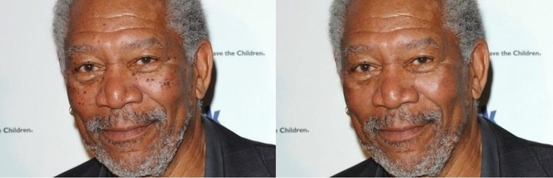 Celebrities stripped down. My (poor) attempt at what some famous (and not-so-famous) people might look like without their trademark freckles. Definitely seems l