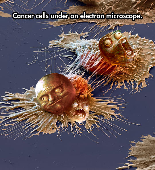 [SHITPOSTING LOUDLY]. Based on this: /Cancer+under+electron+microscope/funny-pictures/5133300/.