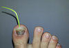 Fun with toothpicks and toenails