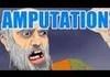 AMPUTATION